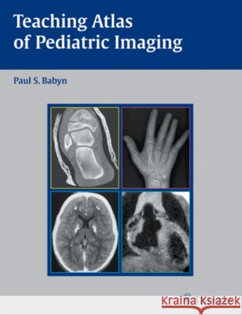 Teaching Atlas of Pediatric Imaging Paul S. Babyn 9781588903396 Thieme Medical Publishers - książka