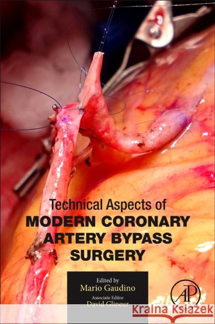 Technical Aspects of Modern Coronary Artery Bypass Surgery Mario Gaudino 9780128203484 Academic Press - książka