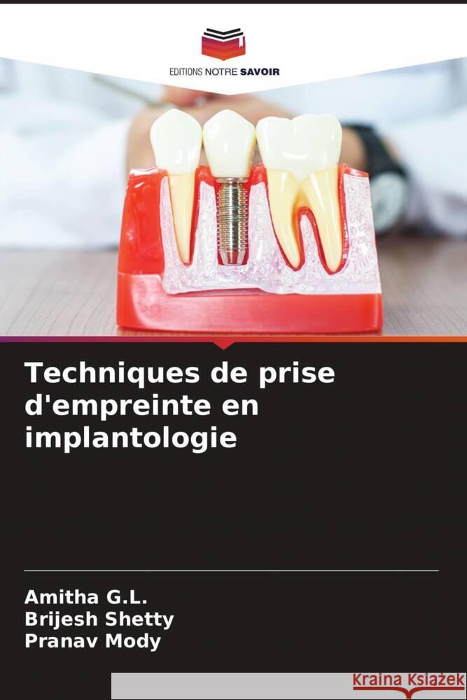 Techniques de prise d'empreinte en implantologie G.L., Amitha, Shetty, Brijesh, Mody, Pranav 9786206300113 Editions Notre Savoir - książka