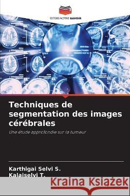 Techniques de segmentation des images c?r?brales Karthigai Selvi S Kalaiselvi T 9786205858509 Editions Notre Savoir - książka