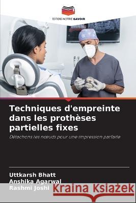 Techniques d\'empreinte dans les proth?ses partielles fixes Uttkarsh Bhatt Anshika Agarwal Rashmi Joshi 9786205759950 Editions Notre Savoir - książka