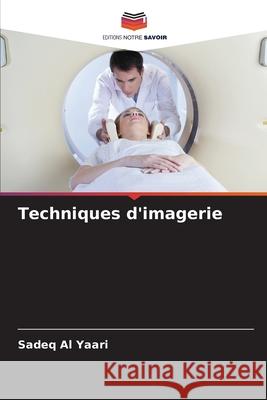 Techniques d'imagerie Al Yaari, Sadeq 9786200714206 Editions Notre Savoir - książka