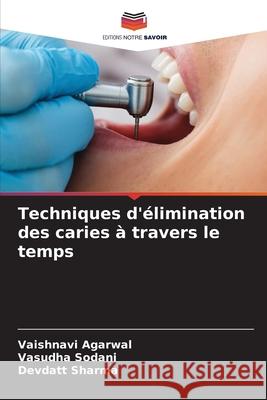 Techniques d'?limination des caries ? travers le temps Vaishnavi Agarwal Vasudha Sodani Devdatt Sharma 9786207529254 Editions Notre Savoir - książka