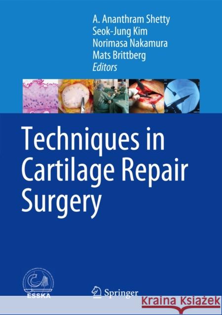 Techniques in Cartilage Repair Surgery A. Ananthram Shetty Seok-Jung Kim Norimasa Nakamura 9783642419201 Springer - książka