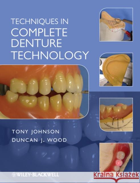Techniques in Complete Denture Johnson, Tony 9781405179096  - książka
