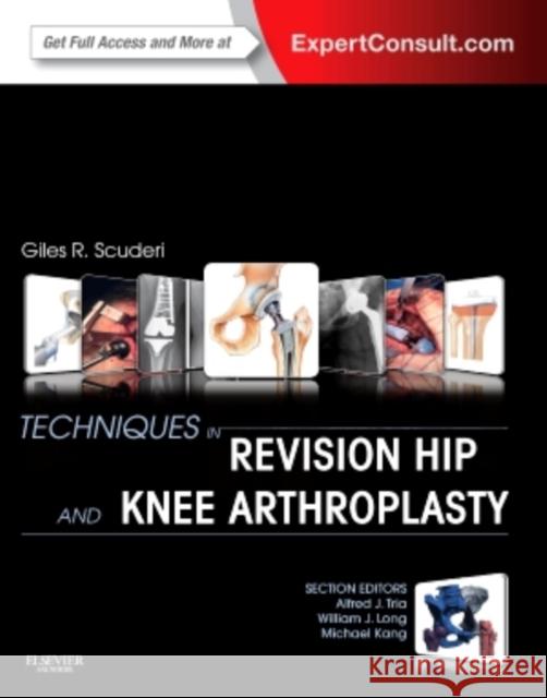 Techniques in Revision Hip and Knee Arthroplasty Giles R. Scuderi   9781455723683 Saunders - książka