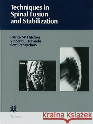 Techniques in Spinal Fusion and Stabilization Patrick W. Hitchon Patrick Hitchon Vincent Traynelis 9780865775237 Thieme Medical Publishers - książka