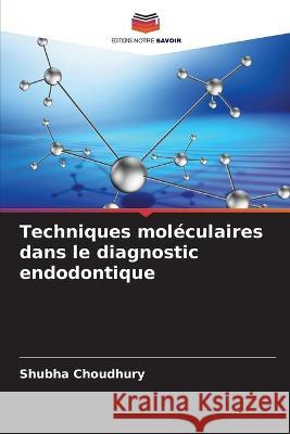 Techniques mol?culaires dans le diagnostic endodontique Shubha Choudhury 9786205693131 Editions Notre Savoir - książka