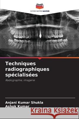 Techniques radiographiques sp?cialis?es Anjani Kumar Shukla Ashok Kumar 9786207560585 Editions Notre Savoir - książka