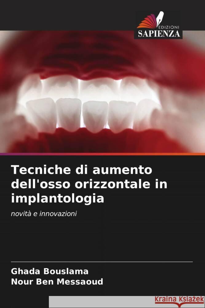 Tecniche di aumento dell'osso orizzontale in implantologia Bouslama, Ghada, Ben Messaoud, Nour 9786208253615 Edizioni Sapienza - książka