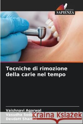 Tecniche di rimozione della carie nel tempo Vaishnavi Agarwal Vasudha Sodani Devdatt Sharma 9786207529292 Edizioni Sapienza - książka