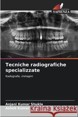 Tecniche radiografiche specializzate Anjani Kumar Shukla Ashok Kumar 9786207560578 Edizioni Sapienza - książka