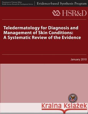 Teledermatology for Diagnosis and Management of Skin Conditions: A Systematic Review of Evidence U. S. Department of Veterans Affairs Health Services Research &. Dev Service 9781489540003 Createspace - książka