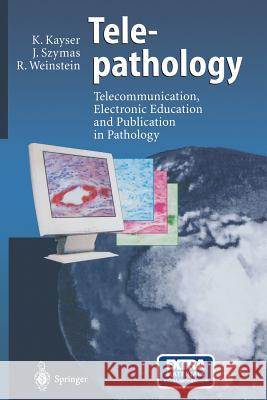 Telepathology: Telecommunication, Electronic Education and Publication in Pathology Kayser, Klaus 9783642642357 Springer - książka