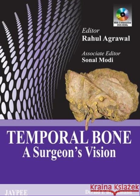 Temporal Bone : A Surgeon's Vision Rahul Agrawal   9789350901748 Jaypee Brothers Medical Publishers - książka