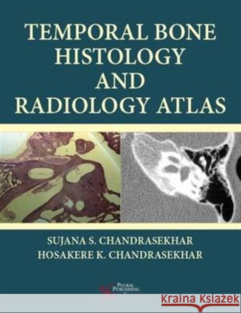 Temporal Bone Histology and Radiology Atlas Sujana S. Chandrasekhar   9781597567169 Plural Publishing Inc - książka