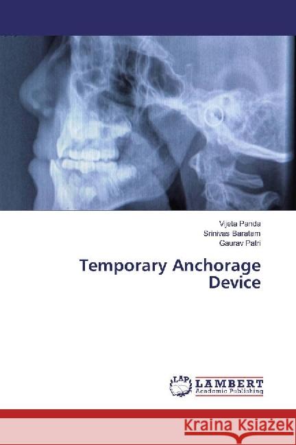 Temporary Anchorage Device Panda, Vijeta; Baratam, Srinivas; Patri, Gaurav 9783330046368 LAP Lambert Academic Publishing - książka