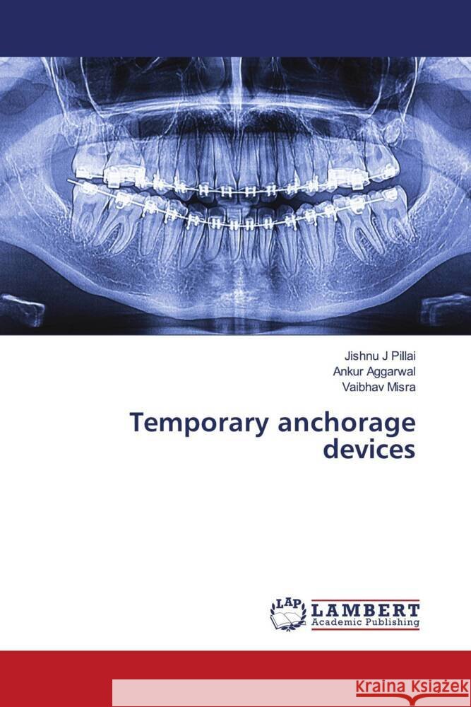 Temporary anchorage devices Pillai, Jishnu J, Aggarwal, Ankur, Misra, Vaibhav 9786203853469 LAP Lambert Academic Publishing - książka
