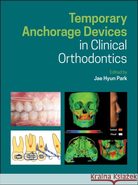 Temporary Anchorage Devices in Clinical Orthodontics Jae Hyun Park 9781119513476 Wiley-Blackwell - książka