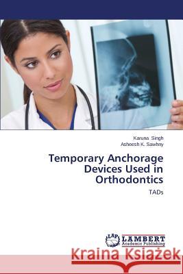 Temporary Anchorage Devices Used in Orthodontics Singh Karuna 9783659562426 LAP Lambert Academic Publishing - książka