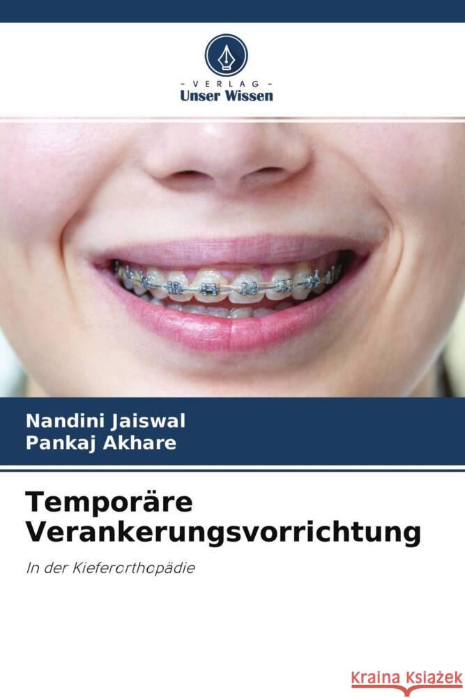 Temporäre Verankerungsvorrichtung Jaiswal, Nandini, Akhare, Pankaj 9786204614168 Verlag Unser Wissen - książka