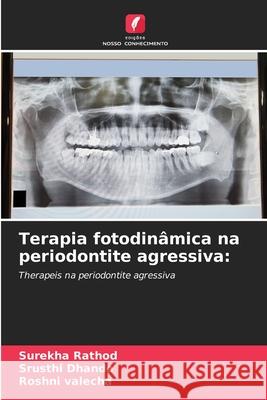Terapia fotodinâmica na periodontite agressiva: Rathod, Surekha, Dhande, Srusthi, valecha, Roshni 9786209319754 Edições Nosso Conhecimento - książka