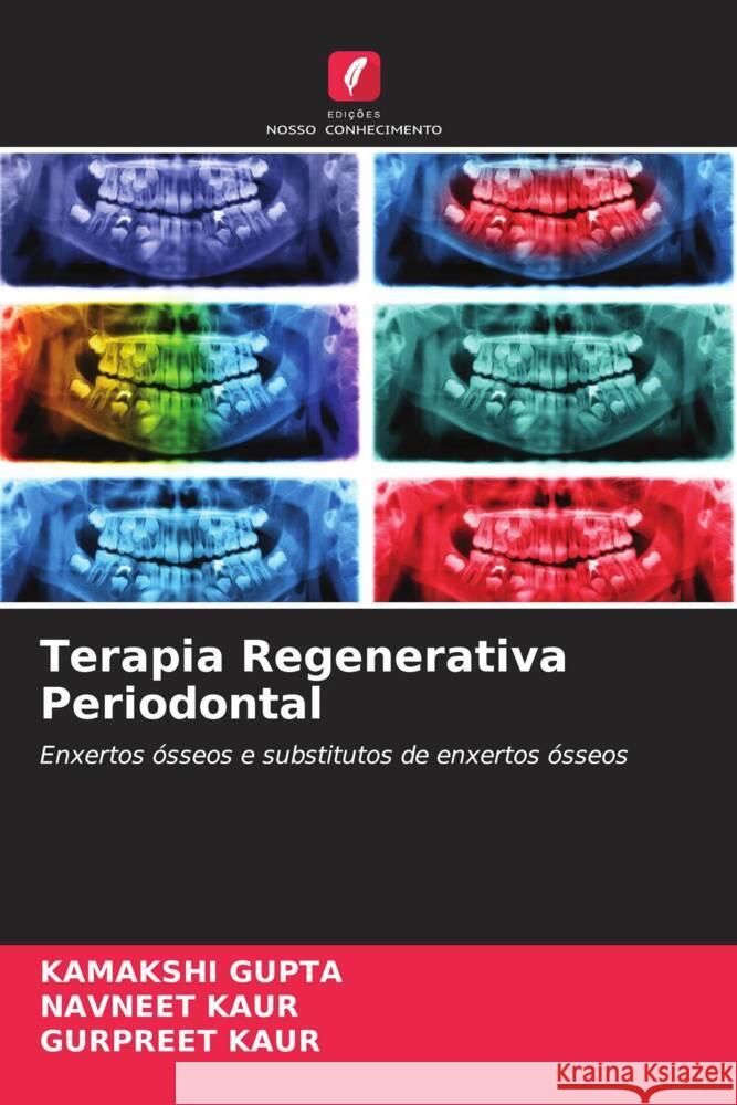 Terapia Regenerativa Periodontal GUPTA, KAMAKSHI, Kaur, Navneet, Kaur, Gurpreet 9786204834283 Edições Nosso Conhecimento - książka