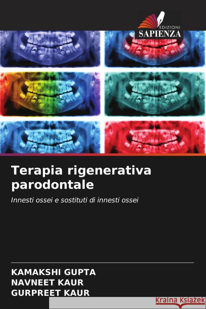 Terapia rigenerativa parodontale GUPTA, KAMAKSHI, Kaur, Navneet, Kaur, Gurpreet 9786204834269 Edizioni Sapienza - książka