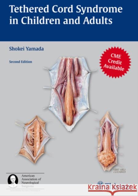 Tethered Cord Syndrome in Children and Adults Shokei Yamada 9781604062410 Thieme Medical Publishers - książka