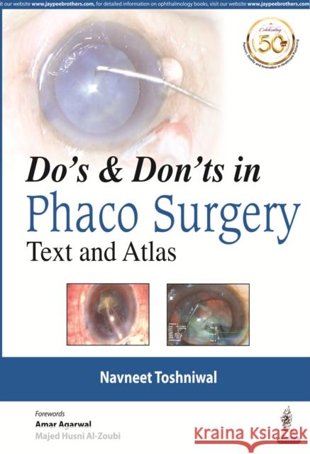 Text and Atlas - Do's and Dont's in Phaco Surgery Navneet Toshniwal   9789389188615 Jaypee Brothers Medical Publishers - książka