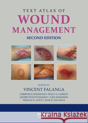 Text Atlas of Wound Management Vincent Falanga 9780415468657  - książka