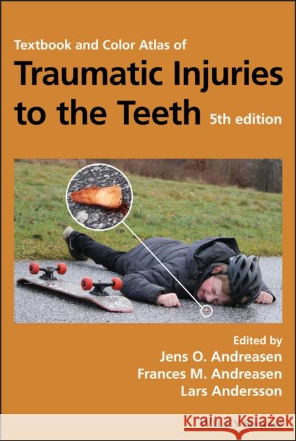 Textbook and Color Atlas of Traumatic Injuries to the Teeth Jens O. Andreasen Frances M. Andreasen Lars Andersson 9781119167051 Wiley-Blackwell - książka
