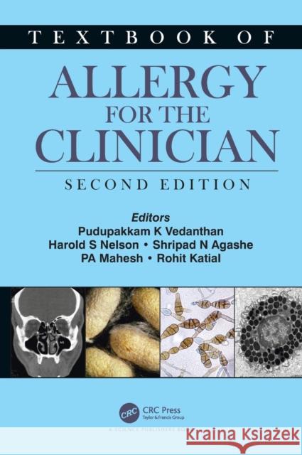 Textbook of Allergy for the Clinician Vedanthan, Pudupakkam K. 9780367405526 CRC Press - książka