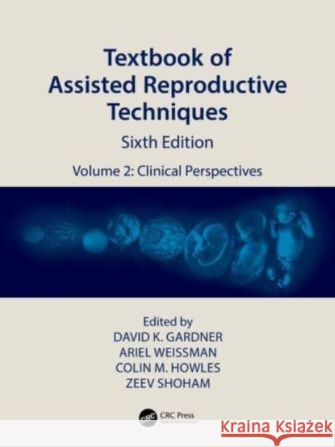 Textbook of Assisted Reproductive Techniques: Volume 2: Clinical Perspectives David K. Gardner Ariel Weissman Colin M. Howles 9781032214801 CRC Press - książka