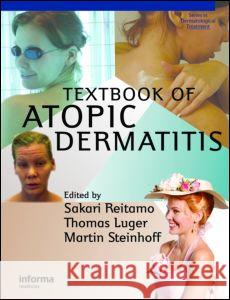 Textbook of Atopic Dermatitis Sakari Reitamo Thomas A. Luger Reitamo Reitamo 9781841842462 Informa Healthcare - książka