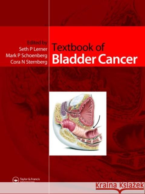 Textbook of Bladder Cancer Seth P. Lerner Mark Schoenberg Cora Sternberg 9781841843827 Informa Healthcare - książka