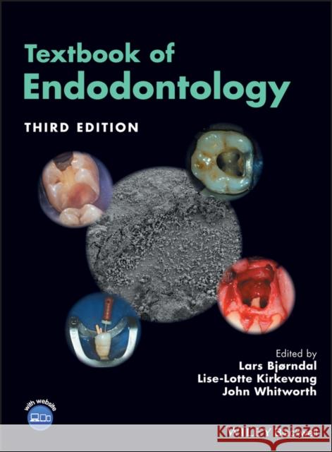 Textbook of Endodontology Lars Bjorndal Lise-Lotte Kirkevang John Whitworth 9781119057314 Wiley-Blackwell - książka