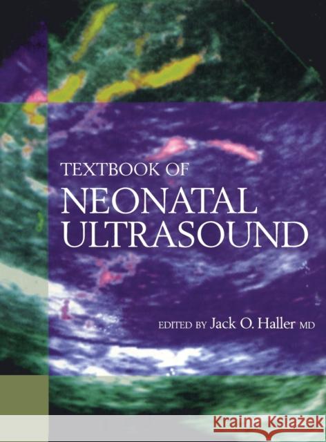 Textbook of Neonatal Ultrasound Jack O. Haller 9781850709022 Taylor & Francis Group - książka