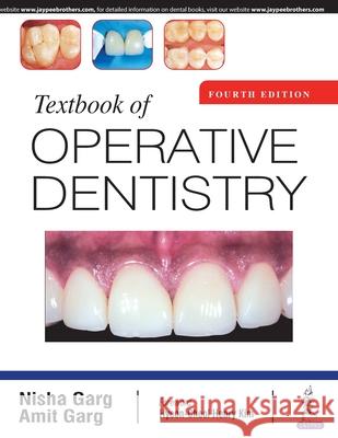 Textbook of Operative Dentistry Nisha Garg Amit Garg  9789389587586 Jaypee Brothers Medical Publishers - książka