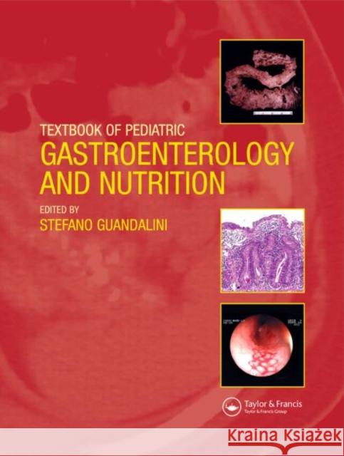 Textbook of Pediatric Gastroenterology and Nutrition Raymond Bonnett Stefano Guandalini Guandalini Guandalini 9781841843155 Taylor & Francis Group - książka