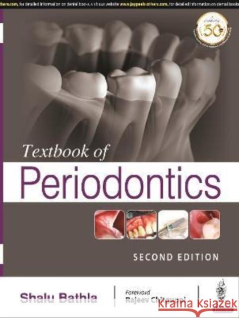 Textbook of Periodontics Shalu Bathla   9789390595365 Jaypee Brothers Medical Publishers - książka