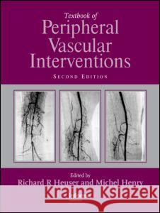 Textbook of Peripheral Vascular Interventions Richard R. Heuser Michel Henry 9781841846439 Taylor & Francis Group - książka