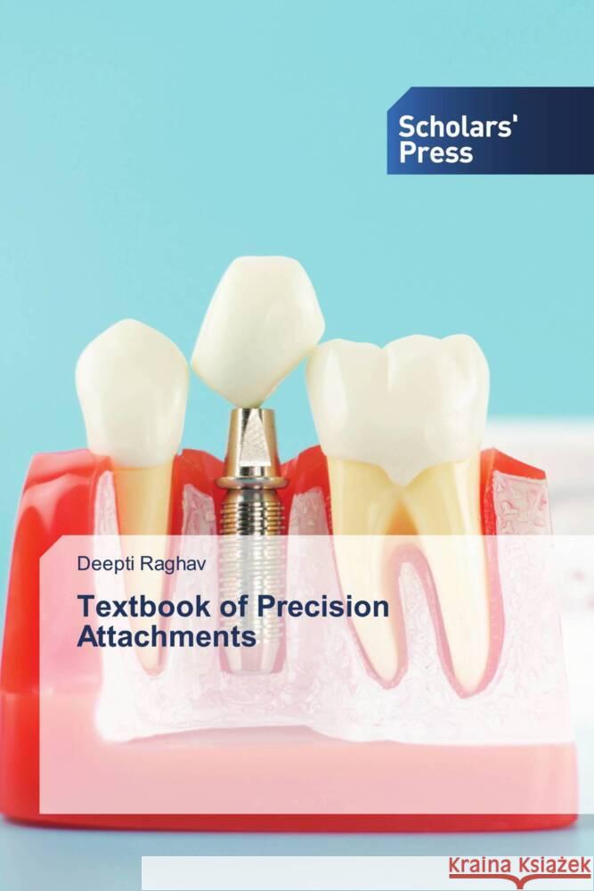 Textbook of Precision Attachments Raghav, Deepti 9786138970088 Scholar's Press - książka