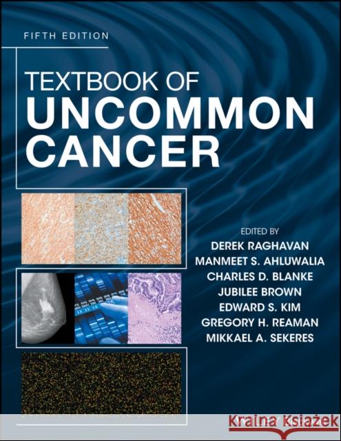 Textbook of Uncommon Cancer  9781119196204 John Wiley & Sons - książka