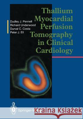 Thallium Myocardial Perfusion Tomography in Clinical Cardiology Dudley J. Pennell S. Richard Underwood Durval C. Costa 9781447118596 Springer - książka