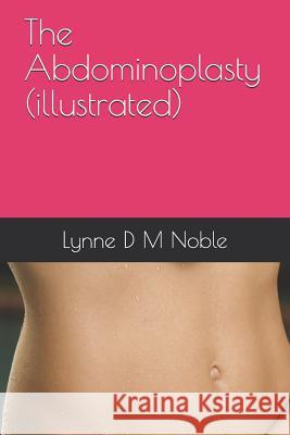 The Abdominoplasty (Illustrated) Lynne D. M. Noble 9781795284554 Independently Published - książka