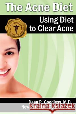 The Acne Diet: Using Diet to Clear Acne Dean R. Goodles 9781468130355 Createspace - książka