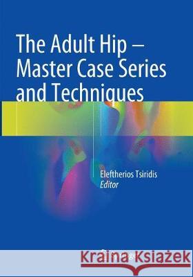 The Adult Hip - Master Case Series and Techniques Eleftherios Tsiridis 9783030097103 Springer - książka