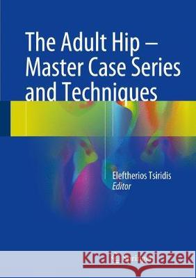 The Adult Hip - Master Case Series and Techniques Eleftherios Tsiridis 9783319641751 Springer - książka