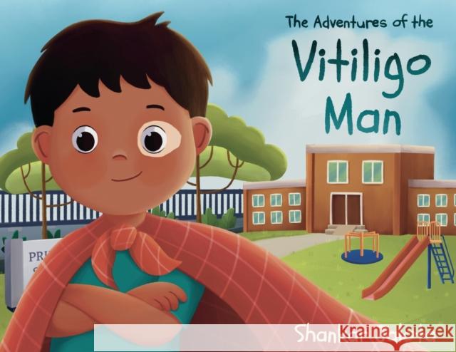 The Adventures of The Vitiligo Man Shankar Jalota Yuyuartt  9781802275650 Publishing Push LTD - książka